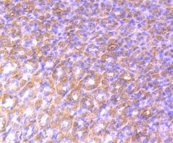 Invitrogen Alix Recombinant Rabbit Monoclonal Antibody (JM85-31) 100 &mu;L;