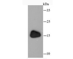 Invitrogen ANP Recombinant Rabbit Monoclonal Antibody (JM08-36) 100 &mu;L | Buy Online | Invitrogen&trade; | Fisher Scientific