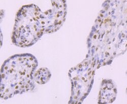 Invitrogen DNA ligase IV Recombinant Rabbit Monoclonal Antibody (JM64-32) 100 &mu;L | Buy Online | Invitrogen&trade; | Fisher Scientific