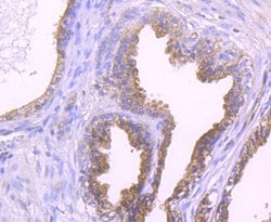 Invitrogen RAPGEF3 Recombinant Rabbit Monoclonal Antibody (JM63-29) 100