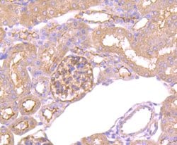 Invitrogen RAPGEF3 Recombinant Rabbit Monoclonal Antibody (JM63-29) 100
