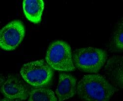 Invitrogen Galectin 1 Recombinant Rabbit Monoclonal Antibody (JM13-37)