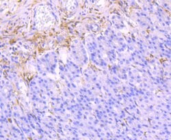 Invitrogen Galectin 1 Recombinant Rabbit Monoclonal Antibody (JM13-37)