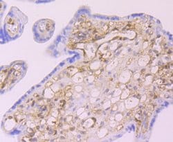 Invitrogen Galectin 1 Recombinant Rabbit Monoclonal Antibody (JM13-37)