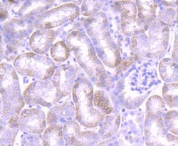 Invitrogen JAK1 Recombinant Rabbit Monoclonal Antibody (JM75-03) 100 &mu;L;