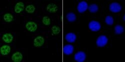 Invitrogen NRF1 Recombinant Rabbit Monoclonal Antibody (JM89-63) 100 &mu;L;