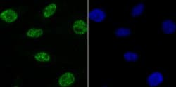 Invitrogen NRF1 Recombinant Rabbit Monoclonal Antibody (JM89-63) 100 &mu;L;