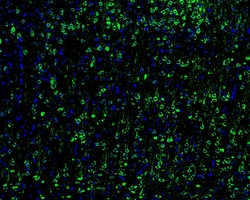 Invitrogen GCLM Recombinant Rabbit Monoclonal Antibody (JM39-61) 100 &mu;L;