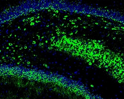 Invitrogen GCLM Recombinant Rabbit Monoclonal Antibody (JM39-61) 100 &mu;L;