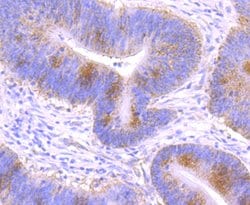 Invitrogen GCLM Recombinant Rabbit Monoclonal Antibody (JM39-61) 100 &mu;L;