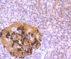 Invitrogen GCLM Recombinant Rabbit Monoclonal Antibody (JM39-61) 100 &mu;L;