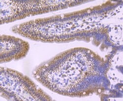 Invitrogen GCLM Recombinant Rabbit Monoclonal Antibody (JM39-61) 100 &mu;L;