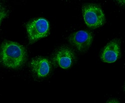 Invitrogen GCLM Recombinant Rabbit Monoclonal Antibody (JM39-61) 100 &mu;L;