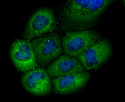Invitrogen GCLM Recombinant Rabbit Monoclonal Antibody (JM39-61) 100 &mu;L;