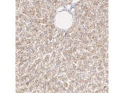 Invitrogen GCLM Recombinant Rabbit Monoclonal Antibody (JM39-61) 100 &mu;L;