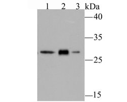Invitrogen GCLM Recombinant Rabbit Monoclonal Antibody (JM39-61) 100 &mu;L;