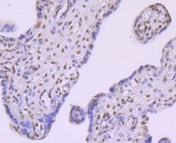 FTO Recombinant Rabbit Monoclonal Antibody (JM98-30), Invitrogen 100 &mu;L;