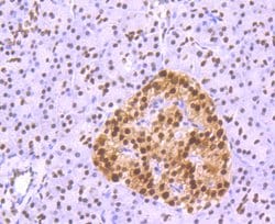 FTO Recombinant Rabbit Monoclonal Antibody (JM98-30), Invitrogen 100 &mu;L;