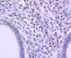 FTO Recombinant Rabbit Monoclonal Antibody (JM98-30), Invitrogen 100 &mu;L;