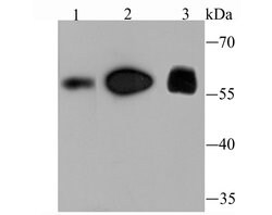 FTO Recombinant Rabbit Monoclonal Antibody (JM98-30), Invitrogen 100 &mu;L;