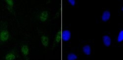 Invitrogen SATB2 Recombinant Rabbit Monoclonal Antibody (JM52-44) 100 &mu;L;