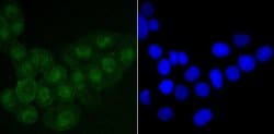 Invitrogen SATB2 Recombinant Rabbit Monoclonal Antibody (JM52-44) 100 &mu;L;
