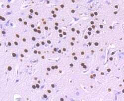 Invitrogen SATB2 Recombinant Rabbit Monoclonal Antibody (JM52-44) 100 &mu;L;