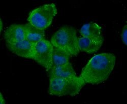 Invitrogen RAD51 Recombinant Rabbit Monoclonal Antibody (JM54-26) 100 &mu;L;