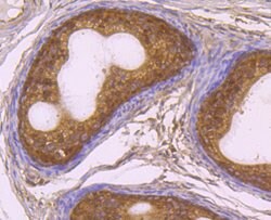 Invitrogen RAD51 Recombinant Rabbit Monoclonal Antibody (JM54-26) 100 &mu;L;