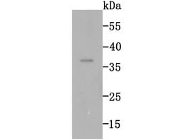 Invitrogen RAD51 Recombinant Rabbit Monoclonal Antibody (JM54-26) 100 &mu;L;