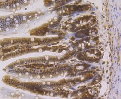 Invitrogen HP1 gamma Recombinant Rabbit Monoclonal Antibody (JU81-36) 100 &mu;L | Buy Online | Invitrogen&trade; | Fisher Scientific