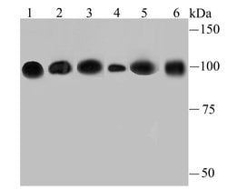 Invitrogen alpha Actinin 4 Recombinant Rabbit Monoclonal Antibody (JU20-23)