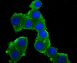 Invitrogen GluR2 Recombinant Rabbit Monoclonal Antibody (JU20-43) 100 &mu;L;