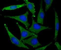 Invitrogen GluR2 Recombinant Rabbit Monoclonal Antibody (JU20-43) 100 &mu;L;