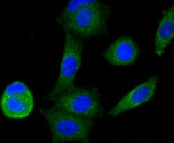 Invitrogen NDUFS3 Recombinant Rabbit Monoclonal Antibody (JU10-32) 100