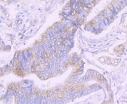 Invitrogen NDUFS3 Recombinant Rabbit Monoclonal Antibody (JU10-32) 100