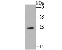 Invitrogen NDUFS3 Recombinant Rabbit Monoclonal Antibody (JU10-32) 100
