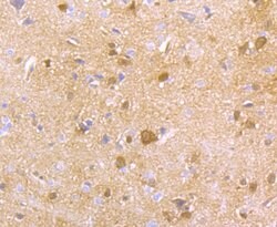Invitrogen HPRT1 Recombinant Rabbit Monoclonal Antibody (JU03-26) 100 &mu;L;