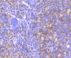 Invitrogen HPRT1 Recombinant Rabbit Monoclonal Antibody (JU03-26) 100 &mu;L;