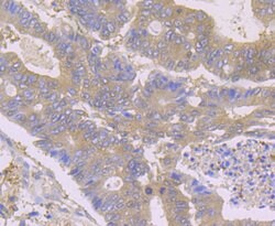 Invitrogen HPRT1 Recombinant Rabbit Monoclonal Antibody (JU03-26) 100 &mu;L;