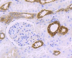 Invitrogen HPRT1 Recombinant Rabbit Monoclonal Antibody (JU03-26) 100 &mu;L;