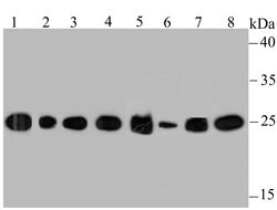 Invitrogen HPRT1 Recombinant Rabbit Monoclonal Antibody (JU03-26) 100 &mu;L;