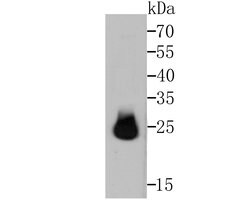 Invitrogen HPRT1 Recombinant Rabbit Monoclonal Antibody (JU03-26) 100 &mu;L;