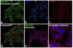 Invitrogen IFITM3 Recombinant Rabbit Monoclonal Antibody (JU73-02) 100