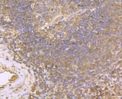 Invitrogen USP10 Recombinant Rabbit Monoclonal Antibody (JU32-62) 100 &mu;L;
