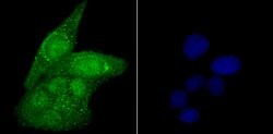 Invitrogen USP22 Recombinant Rabbit Monoclonal Antibody (JU63-27) 100 &mu;L;