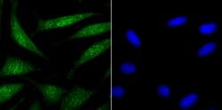 Invitrogen USP22 Recombinant Rabbit Monoclonal Antibody (JU63-27) 100 &mu;L;