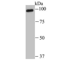 Invitrogen USP13 Recombinant Rabbit Monoclonal Antibody (JU72-38) 100 &mu;L;