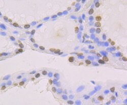 Invitrogen Histone Macro-H2A.1 Recombinant Rabbit Monoclonal Antibody (JU22-83) 100 &mu;L | Buy Online | Invitrogen&trade; | Fisher Scientific