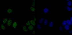 Invitrogen DDB1 Recombinant Rabbit Monoclonal Antibody (JU32-35) 100 &mu;L;